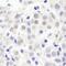 SMG8 Nonsense Mediated MRNA Decay Factor antibody, NB100-74598, Novus Biologicals, Immunohistochemistry frozen image 