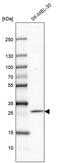 Family With Sequence Similarity 168 Member A antibody, PA5-58020, Invitrogen Antibodies, Western Blot image 