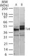 Single Ig And TIR Domain Containing antibody, PA1-41406, Invitrogen Antibodies, Western Blot image 