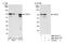 Origin Recognition Complex Subunit 2 antibody, NBP1-46176, Novus Biologicals, Western Blot image 