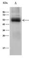 Alpha-1-antiproteinase antibody, GTX02323, GeneTex, Immunoprecipitation image 