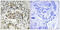 HMG-Box Transcription Factor 1 antibody, A03046S402, Boster Biological Technology, Immunohistochemistry paraffin image 