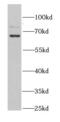 Kinesin Light Chain 1 antibody, FNab04594, FineTest, Western Blot image 