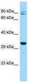 Inositol Monophosphatase 2 antibody, TA344407, Origene, Western Blot image 