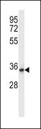 Quinolinate Phosphoribosyltransferase antibody, LS-C162350, Lifespan Biosciences, Western Blot image 