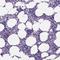 Peroxisomal Biogenesis Factor 12 antibody, HPA069386, Atlas Antibodies, Immunohistochemistry paraffin image 