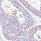 Chromosome 9 Open Reading Frame 24 antibody, NBP2-14425, Novus Biologicals, Immunohistochemistry paraffin image 