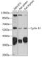 Cyclin B1 antibody, 16-390, ProSci, Western Blot image 