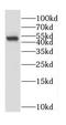 Fc-gamma-RIIa antibody, FNab01465, FineTest, Western Blot image 