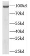 Matrix Extracellular Phosphoglycoprotein antibody, FNab05129, FineTest, Western Blot image 