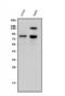 Protein DBF4 homolog A antibody, A01348-2, Boster Biological Technology, Western Blot image 