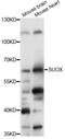 Sulfite Oxidase antibody, LS-C749263, Lifespan Biosciences, Western Blot image 