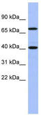 SLAIN Motif Family Member 2 antibody, TA344197, Origene, Western Blot image 