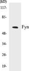 FYN Proto-Oncogene, Src Family Tyrosine Kinase antibody, EKC1227, Boster Biological Technology, Western Blot image 