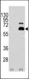 Ribosomal Protein S6 Kinase B1 antibody, TA302198, Origene, Western Blot image 