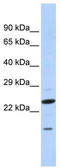 Insulin Induced Gene 2 antibody, TA345660, Origene, Western Blot image 