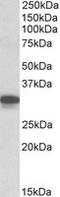 Cytochrome B5 Reductase 3 antibody, LS-C139732, Lifespan Biosciences, Western Blot image 