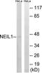 DNA-(apurinic or apyrimidinic site) lyase Neil1 antibody, TA312656, Origene, Western Blot image 