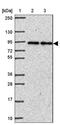 Ankyrin-1 antibody, NBP2-33806, Novus Biologicals, Western Blot image 