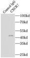 Atypical Chemokine Receptor 3 antibody, FNab02104, FineTest, Immunoprecipitation image 