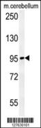 N(Alpha)-Acetyltransferase 25, NatB Auxiliary Subunit antibody, 55-116, ProSci, Western Blot image 