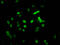 Histone Cluster 1 H1 Family Member E antibody, LS-C670373, Lifespan Biosciences, Immunofluorescence image 