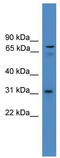 Zinc Finger Protein 691 antibody, TA345183, Origene, Western Blot image 
