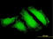 Forkhead Box O3 antibody, LS-C133204, Lifespan Biosciences, Immunofluorescence image 