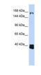 Uncharacterized protein C10orf12 antibody, NBP1-70426, Novus Biologicals, Western Blot image 