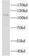 Insulin Degrading Enzyme antibody, FNab04116, FineTest, Western Blot image 