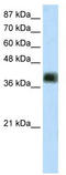 Zinc Finger And SCAN Domain Containing 16 antibody, TA341405, Origene, Western Blot image 