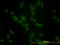 Glucosylceramidase Beta antibody, LS-C104954, Lifespan Biosciences, Immunofluorescence image 