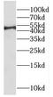Interferon Regulatory Factor 9 antibody, FNab04397, FineTest, Western Blot image 