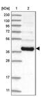 Ribonuclease P/MRP Subunit P40 antibody, PA5-57364, Invitrogen Antibodies, Western Blot image 