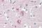Cytokeratin Pan  antibody, NBP1-52557, Novus Biologicals, Immunohistochemistry paraffin image 