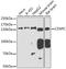 Centromere Protein C antibody, A06766, Boster Biological Technology, Western Blot image 