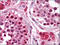 Replication Protein A3 antibody, AM06058PU-N, Origene, Immunohistochemistry paraffin image 