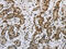 Histone Cluster 1 H2A Family Member E antibody, CSB-PA949550, Cusabio, Immunohistochemistry frozen image 