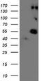 Lysyl Oxidase antibody, M00575-1, Boster Biological Technology, Western Blot image 