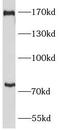 Plexin B2 antibody, FNab06545, FineTest, Western Blot image 