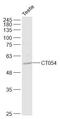 Riboflavin transporter 2 antibody, GTX51591, GeneTex, Western Blot image 