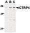 C1q And TNF Related 4 antibody, LS-B466, Lifespan Biosciences, Western Blot image 