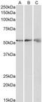 ATP Synthase F1 Subunit Beta antibody, TA329077, Origene, Western Blot image 