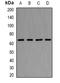 Nuclear pore glycoprotein p62 antibody, orb381925, Biorbyt, Western Blot image 