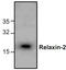 Relaxin 2 antibody, TA319002, Origene, Western Blot image 