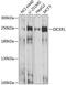 Dicer 1, Ribonuclease III antibody, 19-979, ProSci, Western Blot image 