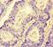 Neuropilin 2 antibody, orb43850, Biorbyt, Immunohistochemistry paraffin image 