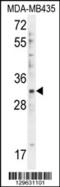 DTW Domain Containing 1 antibody, 55-897, ProSci, Western Blot image 