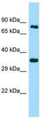 Hook Microtubule Tethering Protein 3 antibody, TA337954, Origene, Western Blot image 