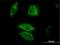 Dual Specificity Phosphatase 6 antibody, H00001848-M01, Novus Biologicals, Immunofluorescence image 